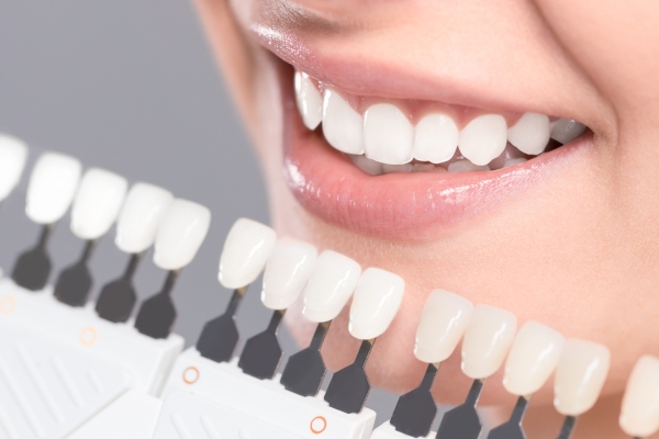 Prótesis dentales fijas, ¿cuáles son sus ventajas?