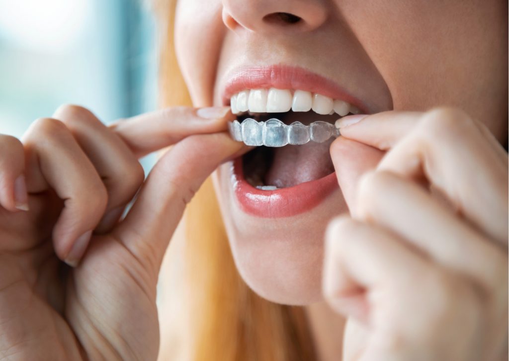 ¿Soy demasiado mayor para un tratamiento de ortodoncia?