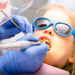 Traumatismos dentales en la infancia - Clínica dental Bayona
